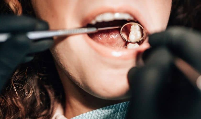 Bone Graft Procedure