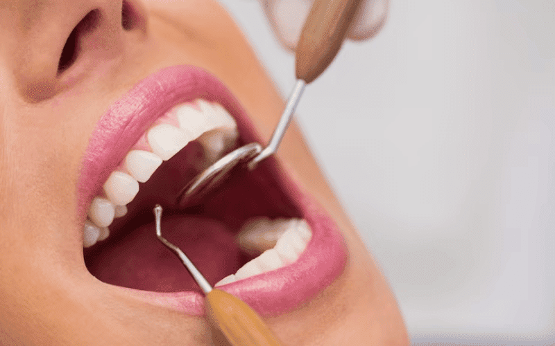 Tooth-Friendly - Beverly Hills Oral Surgeon