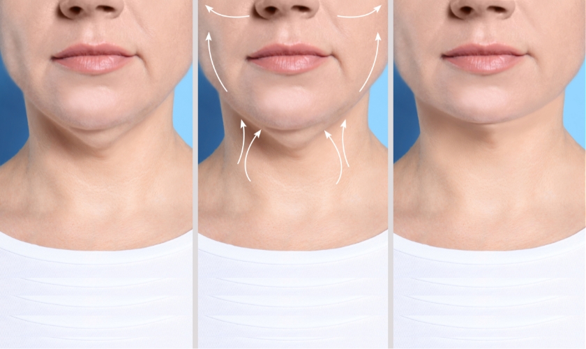 does corrective jaw surgery change your facial appearance