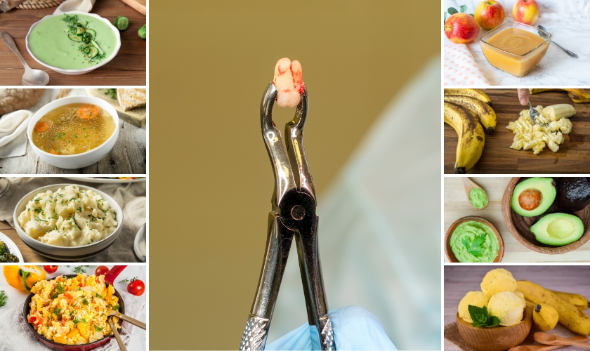 eat after wisdom teeth removal