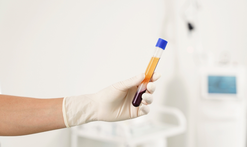 benefits of using platelet rich plasma in dental procedures