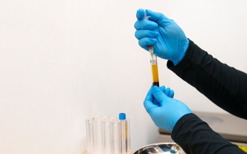 PRP Treatment Help In Oral Surgery Recovery